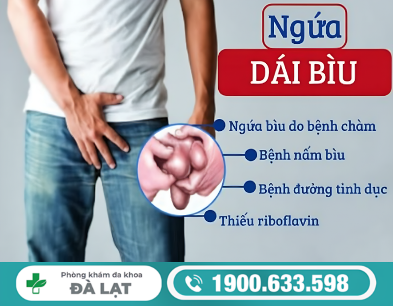 Hình ảnh minh họa